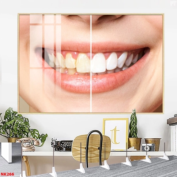 Tranh Treo Tường Nha Khoa tẩy Trắng Răng