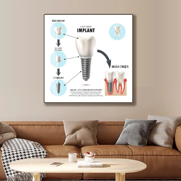 Tranh Treo Tường Nha Khoa Cấy Ghép IMPLANT